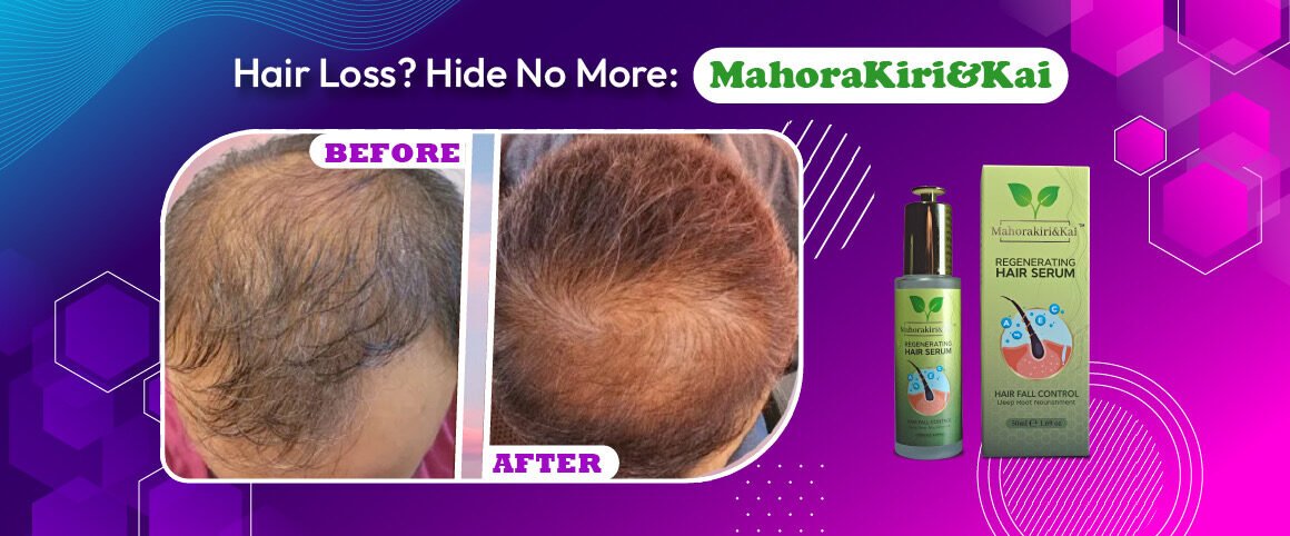 Don’t Hide Your Hair Anymore! Discover the Magic of MahoraKiri&Kai Regenerating Hair Serum!