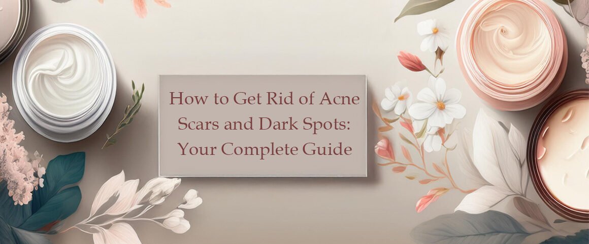 How to Get Rid of Acne Scars and Dark Spots: Your Complete Guide